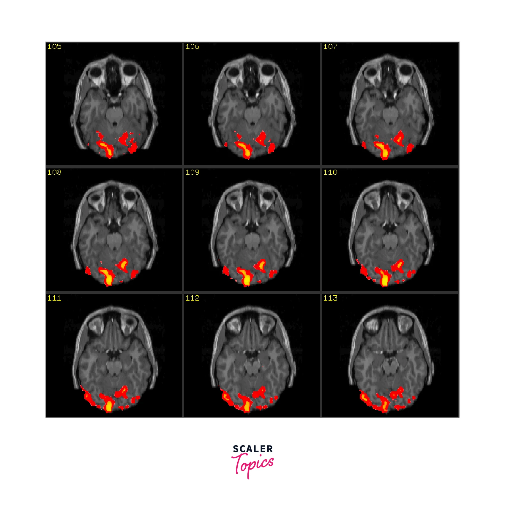 applications-of-ai-in-psychology